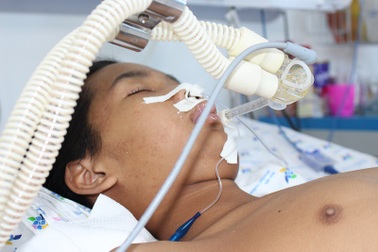 Thiếu niên 13 tuổi liệt toàn thân vì viêm não Nhật Bản