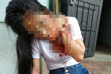 Cụ ông đâm trọng thương con gái của “vợ hờ”