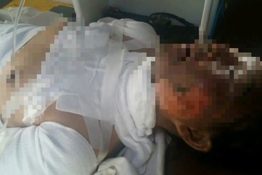 Vụ ôm người tình tự thiêu: Nạn nhân từng bị đánh đập, hiếp dâm và dọa giết (!?)