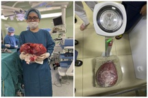 Sốc: Khối u 10kg trong bụng nữ bệnh nhân