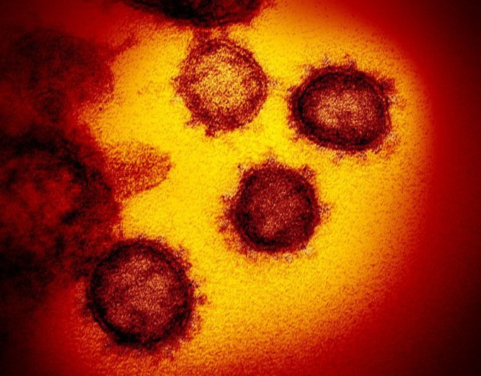 Hình ảnh thật sự của virus corona Covid-19 mới được trình diện - Ảnh 4. Hình ảnh thật sự của virus corona Covid-19 mới được trình diện - Ảnh 4.