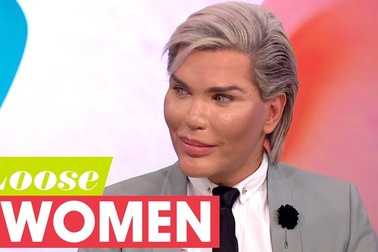 Rodrigo Alves tuyên bố không dừng phẫu thuật thẩm mỹ