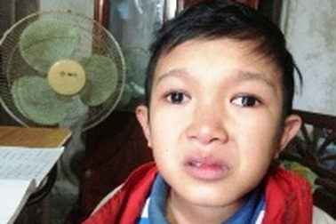 Tâm sự rơi nước mắt của cậu bé 15 tuổi bị mù hai mắt