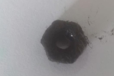 Bé 3 tuổi đau mũi cả tuần, bác sĩ gắp ra con ốc xe đạp