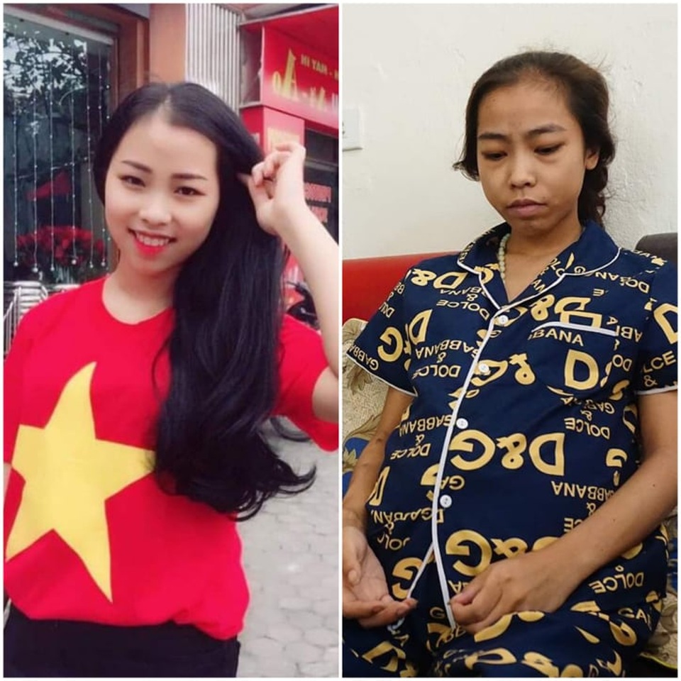 Nỗi đau của cô gái suy thận, ngày lên xe hoa bị hoãn vô thời hạn - 2 Nỗi đau của cô gái suy thận, ngày lên xe hoa bị hoãn vô thời hạn - 2