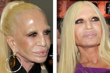 Nhà thiết kế Donatella Versace tái xuất sau khi lộ mặt cứng đơ