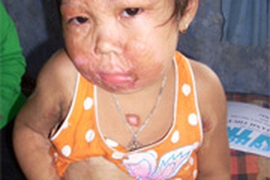 Tiếp tục trao quà cho bé Hồ Thị Thanh Thuỷ và bà Ngô Thị Bòng