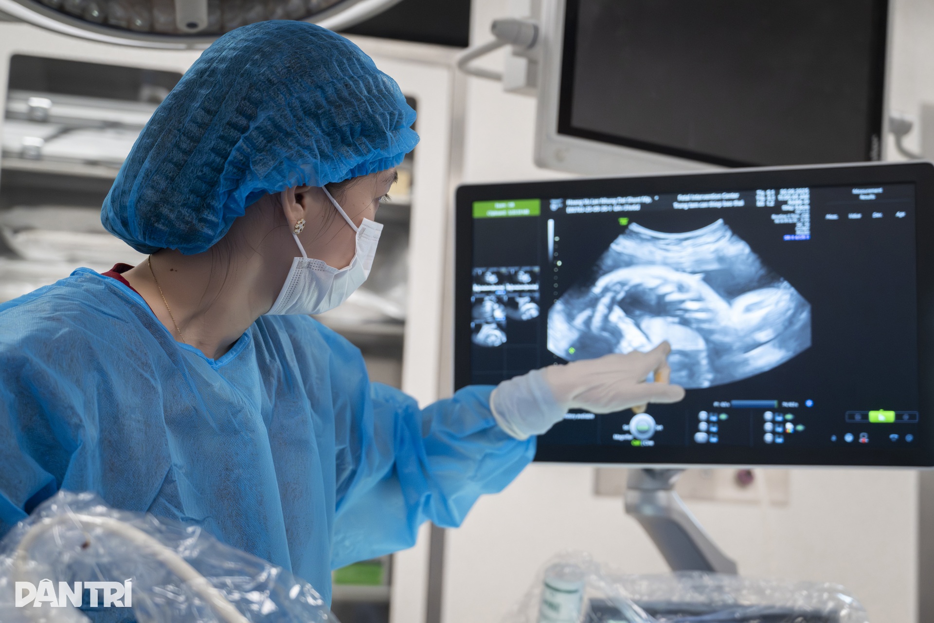Doktor menggunakan jarum sebagai benang untuk menyelamatkan Bác sĩ dùng kim như sợi chỉ cứu “thiên thần” tràn dịch phổi trong bụng mẹ - 16