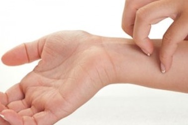 Bệnh mề đay trị sao cho dứt?