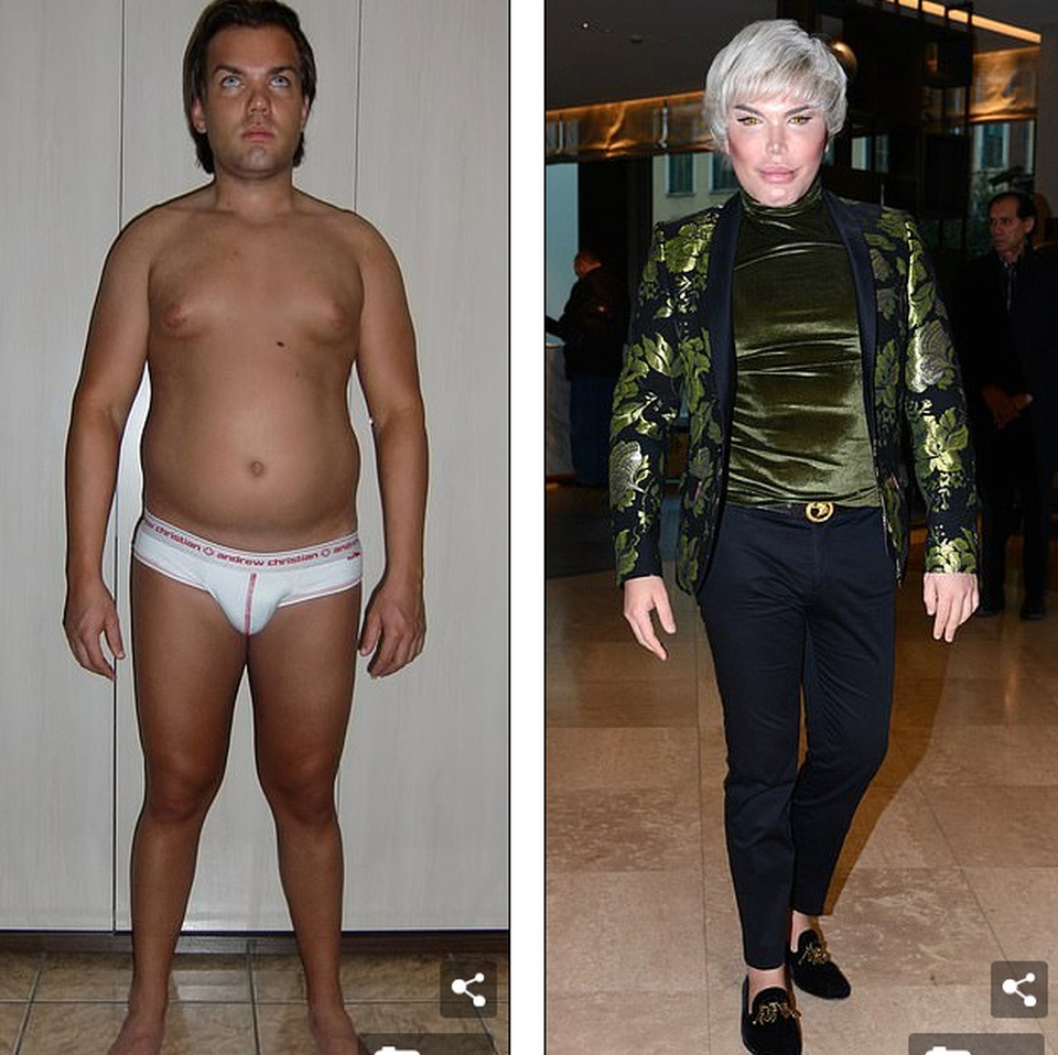 Sao nghiện dao kéo Rodrigo Alves xuất hiện sau tuyên bố chuyển giới - 8 Sao nghiện dao kéo Rodrigo Alves xuất hiện sau tuyên bố chuyển giới - 8