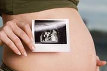 Đúng sai chuyện siêu âm thai