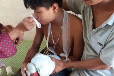 Máy tính xách tay phát nổ, 3 học sinh bị thương