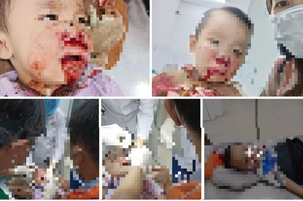 Phó Giám đốc Công an tỉnh lên tiếng vụ CSGT bị tố đánh cháu bé 5 tuổi - 1 Phó Giám đốc Công an tỉnh lên tiếng vụ CSGT bị tố đánh cháu bé 5 tuổi - 1