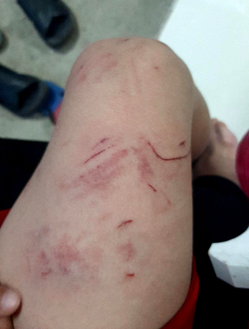 Vì sao đàn khỉ liên tục hung hãn tấn công người? - 2 Vì sao đàn khỉ liên tục hung hãn tấn công người? - 2