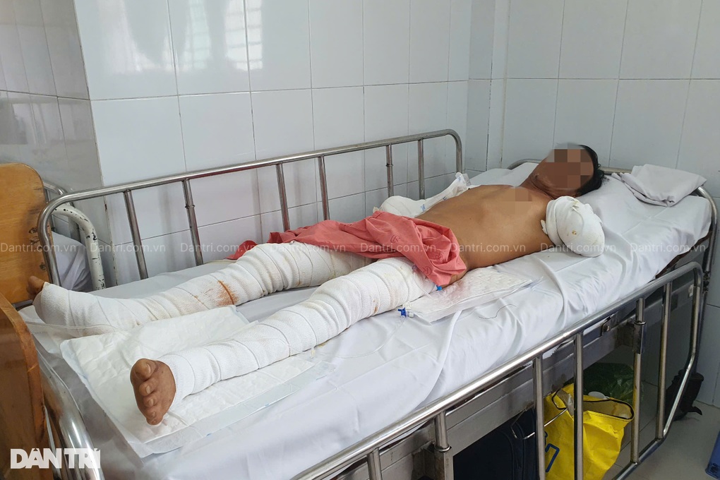 Người đàn ông bị điện phóng cụt 2 tay nghẹn ngào: Mọi người đừng như tôi - 1 Người đàn ông bị điện phóng cụt 2 tay nghẹn ngào: Mọi người đừng như tôi - 1