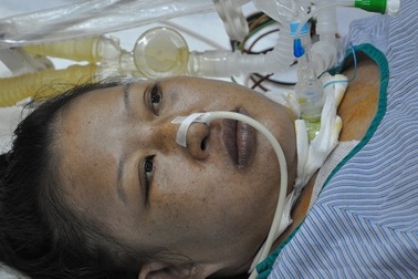 Ánh mắt cầu cứu của người đàn bà bị suy tim nặng