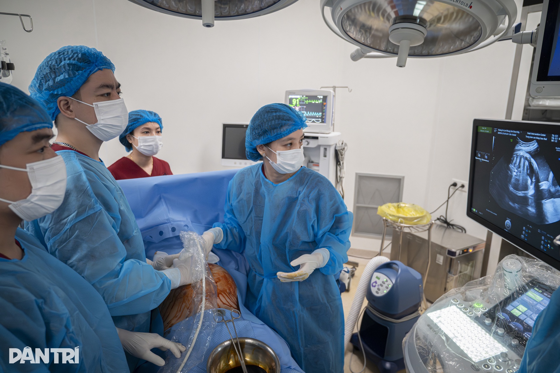 Doktor menggunakan jarum sebagai benang untuk menyelamatkan Bác sĩ dùng kim như sợi chỉ cứu “thiên thần” tràn dịch phổi trong bụng mẹ - 6