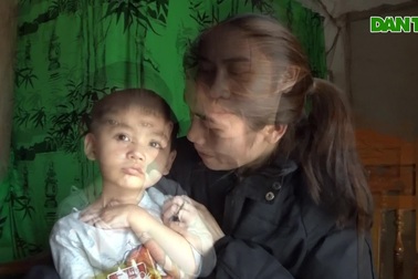 Âm thanh đầu đời của cậu bé gần 3 tuổi