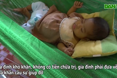 Người mẹ nghèo khẩn cầu sự sống cho con gái bị teo mật bẩm sinh