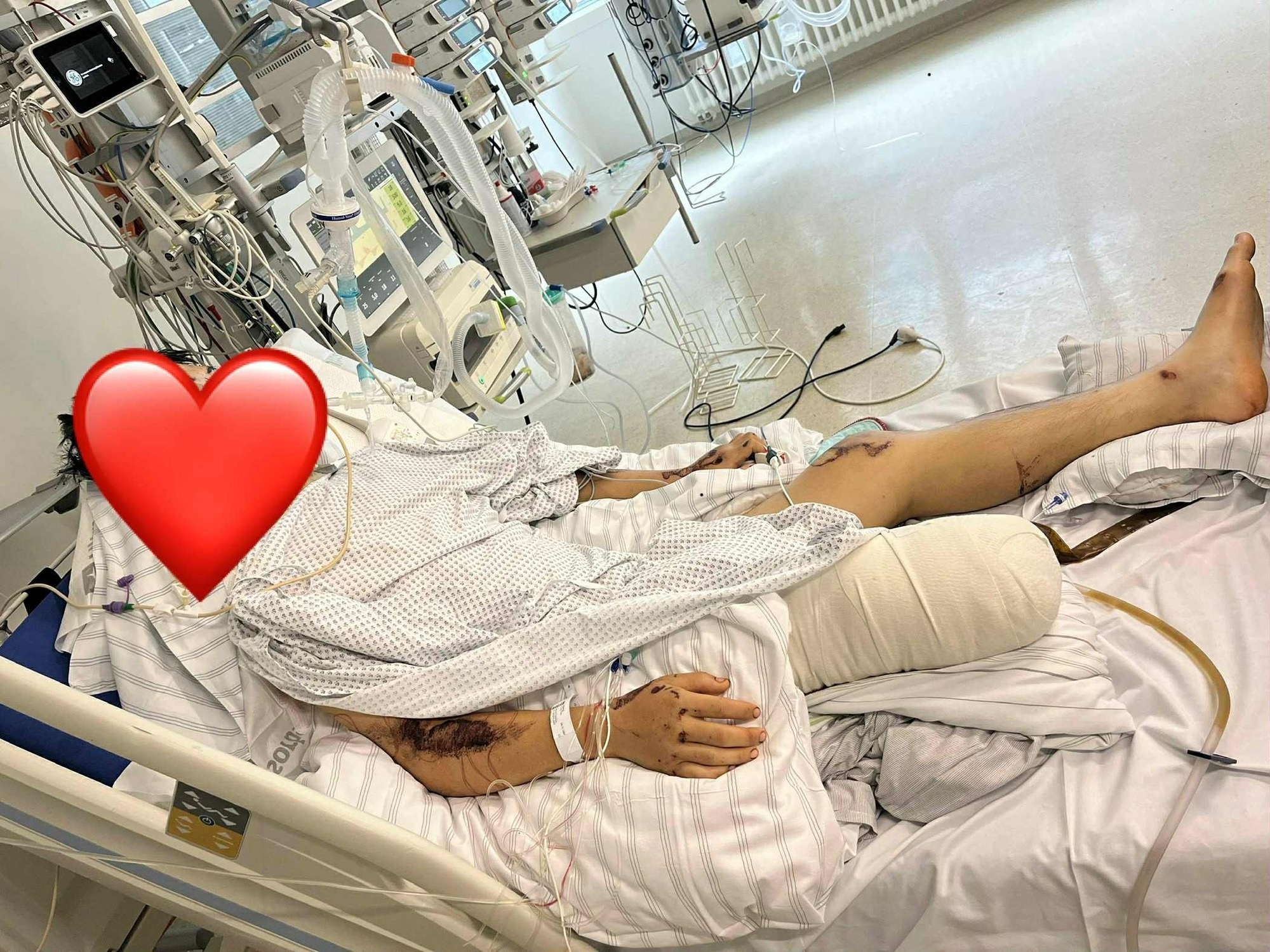 Tiktoker Bốp nguy kịch vì tài xế hít khí cười: Bẫy độc mê hoặc người trẻ - 1