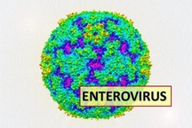 Dấu hiệu cảnh báo viêm màng não virus dễ mắc khi giao mùa
