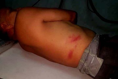 Xác minh cô gái trẻ cầm cây đánh cụ ông trọng thương