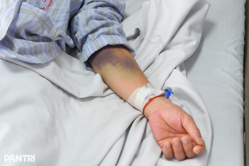 Ngỡ chỉ là cơn sốt nhẹ, người đàn ông rơi vào sốc sốt xuất huyết nguy kịch - 8 Ngỡ chỉ là cơn sốt nhẹ, người đàn ông rơi vào sốc sốt xuất huyết nguy kịch - 8