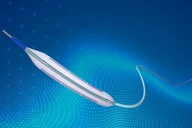 Can thiệp thành công cho bệnh nhân tái hẹp nặng mạch vành sau 15 năm đặt stent