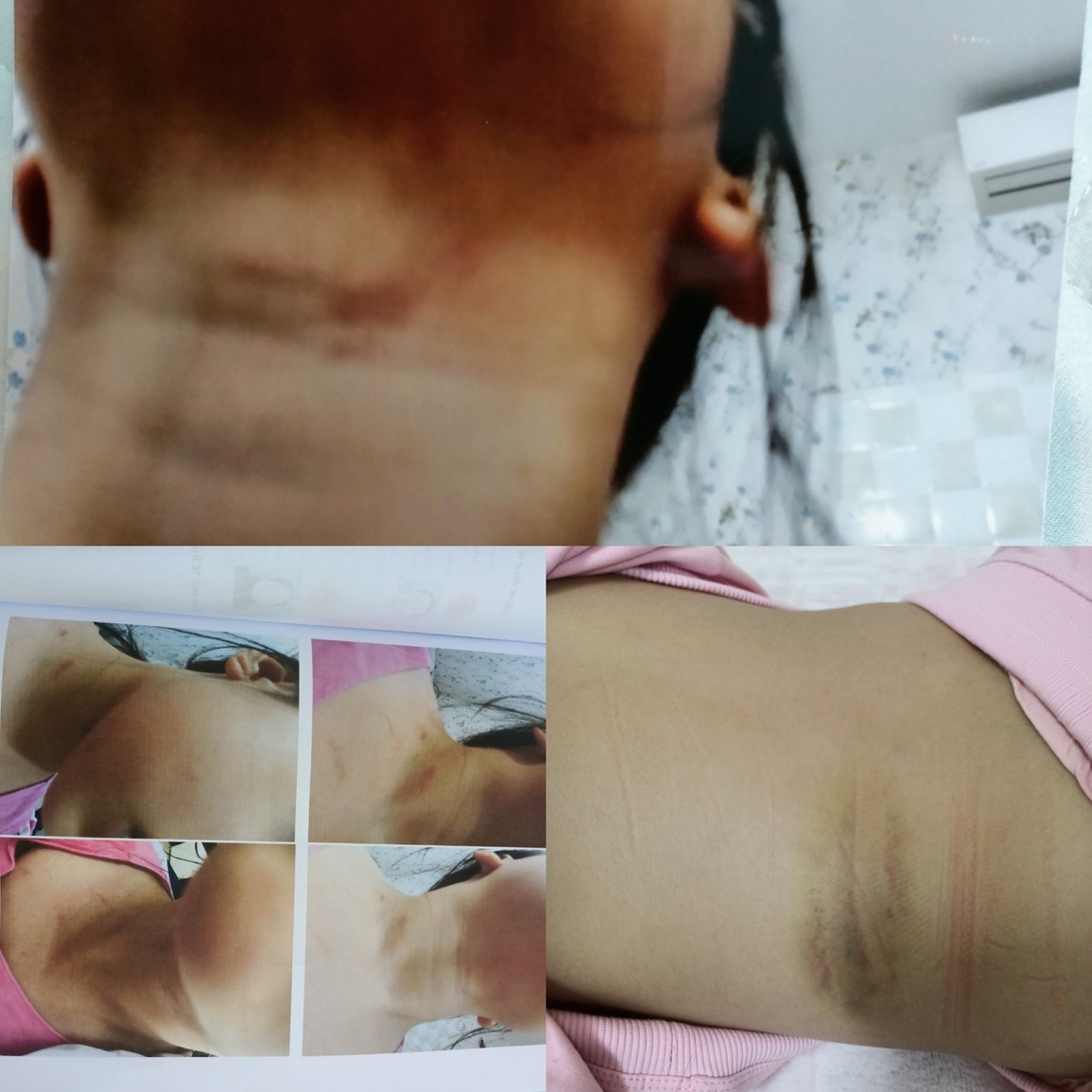 Nghi án hai cháu bé bị bố dượng bạo hành ở Hà Nội - 1 Nghi án hai cháu bé bị bố dượng bạo hành ở Hà Nội - 1