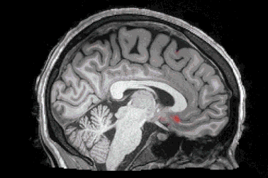 Bộ não sẽ tự “rửa sạch” các chất độc khi chúng ta ngủ theo đúng nghĩa đen