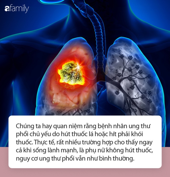 Không bao giờ hút thuốc, 3 phụ nữ sau vẫn bị ung thư phổi như thường! - Ảnh 1.