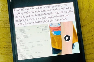 Phụ huynh tố giáo viên "dạy dỗ" học sinh quá tay