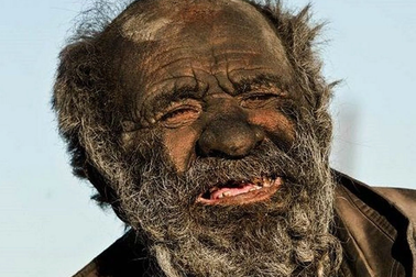 Vì sao "người bẩn nhất thế giới" qua đời sau khi tắm?