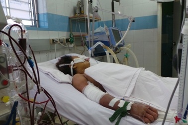Cứu bệnh nhân sốc sốt xuất huyết biến chứng suy đa cơ quan