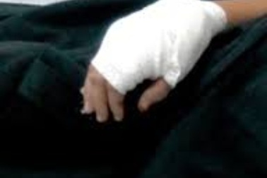 Phó Công an huyện bị chém trọng thương