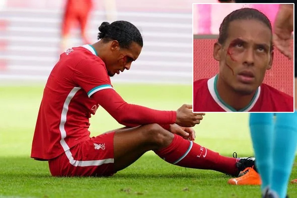 Van Dijk đổ máu trong trận Liverpool may mắn hòa Salzburg - 3 Van Dijk đổ máu trong trận Liverpool may mắn hòa Salzburg - 3