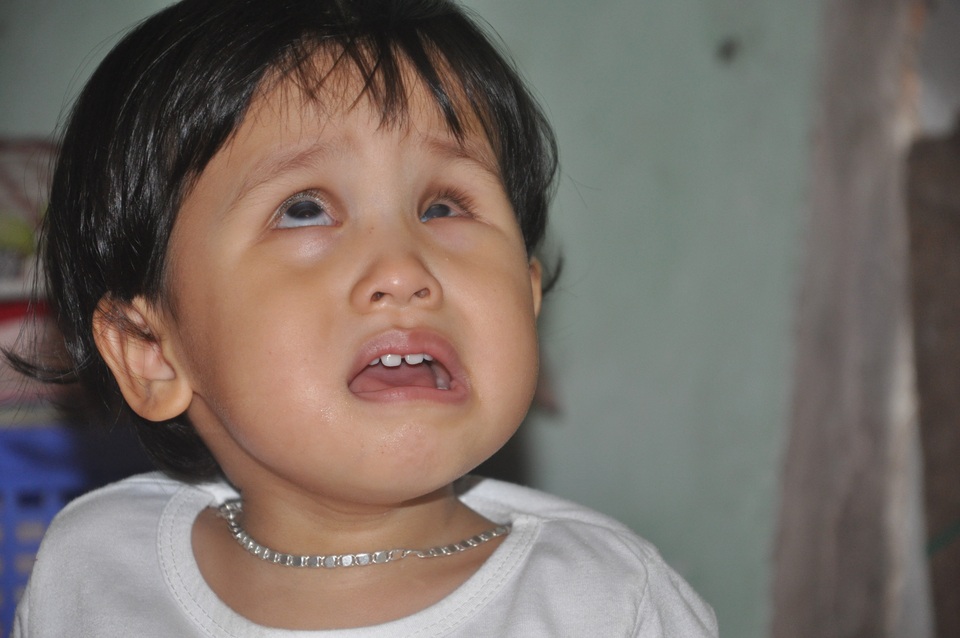 Thương bé gái khi sinh ra đã bị hỏng đôi mắt - 1 Thương bé gái khi sinh ra đã bị hỏng đôi mắt - 1