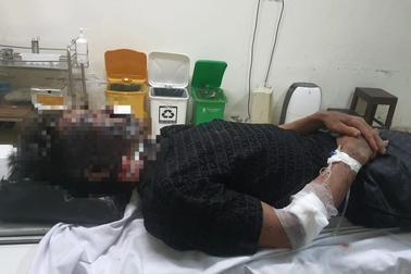 2 thanh niên bị sét đánh trúng khi đi soi cá đêm