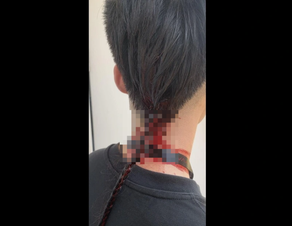 Hà Nội: Sinh viên hành hung bạn đổ máu tại trường học - 2 Hà Nội: Sinh viên hành hung bạn đổ máu tại trường học - 2