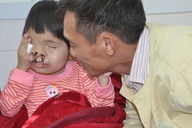 Cậu bé có khuôn mặt kì dị đã nhập viện chữa bệnh