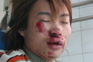 “Chưa đủ cơ sở để kết luận CSGT đánh người”