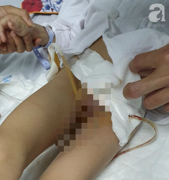 Mẹ khóc cạn nước mắt vì đứa con trai bại não bị 4 con chó cắn đứt bộ phận sinh dục - Ảnh 1. Mẹ khóc cạn nước mắt vì đứa con trai bại não bị 4 con chó cắn đứt bộ phận sinh dục - Ảnh 1.