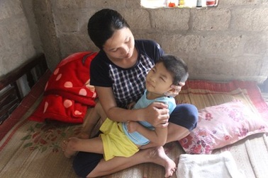 Cha gặp tai nạn, 2 con thơ bị dị tật bẩm sinh rơi vào cảnh đói khát