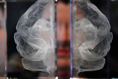 6 yếu tố làm tăng nguy cơ mắc bệnh Alzheimer