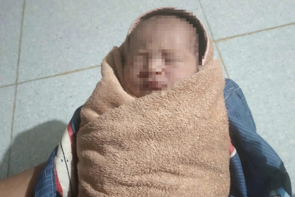 Bé sơ sinh bị bỏ dưới gốc cây đã được đưa về nhà mẹ đẻ - 1 Bé sơ sinh bị bỏ dưới gốc cây đã được đưa về nhà mẹ đẻ - 1