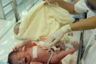 Tai biến sản khoa: đừng đổ tại vô tình