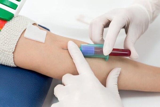 3 xét nghiệm sàng lọc trước sinh đặc biệt quan trọng trong thai kỳ, các mẹ bầu cần chú ý đi thực hiện đúng lịch - Ảnh 3. 3 xét nghiệm sàng lọc trước sinh đặc biệt quan trọng trong thai kỳ, các mẹ bầu cần chú ý đi thực hiện đúng lịch - Ảnh 3.
