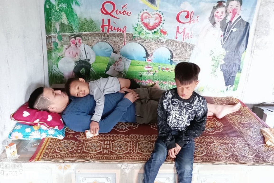 Ông bố trẻ bị vỡ mạch máu não cầu cứu được sống để nuôi 3 con thơ dại - 3 Ông bố trẻ bị vỡ mạch máu não cầu cứu được sống để nuôi 3 con thơ dại - 3