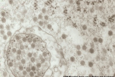 Giải mã một virus gây chết người