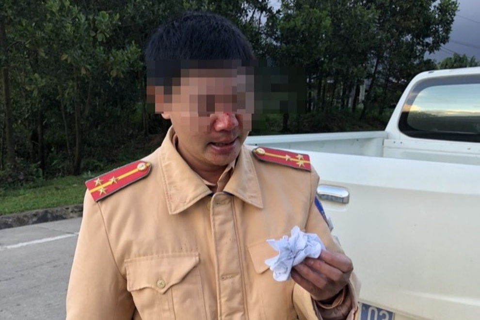 Thông chốt kiểm dịch, nam thanh niên tấn công Cảnh sát giao thông - 2 Thông chốt kiểm dịch, nam thanh niên tấn công Cảnh sát giao thông - 2